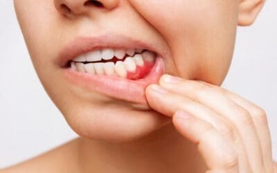 Protecting Your Gums: Everything You Need to Know About Periodontal Disease